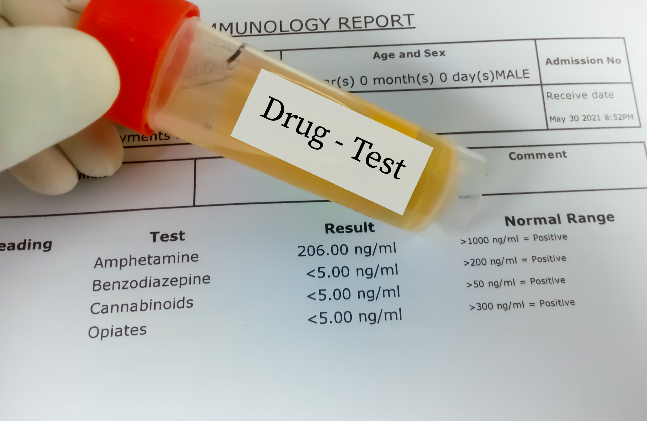 Drug testing in child custody case